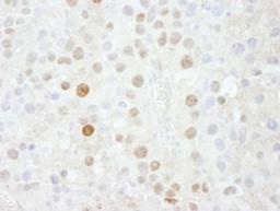 Detection of mouse FOXK1 by immunohistochemistry.