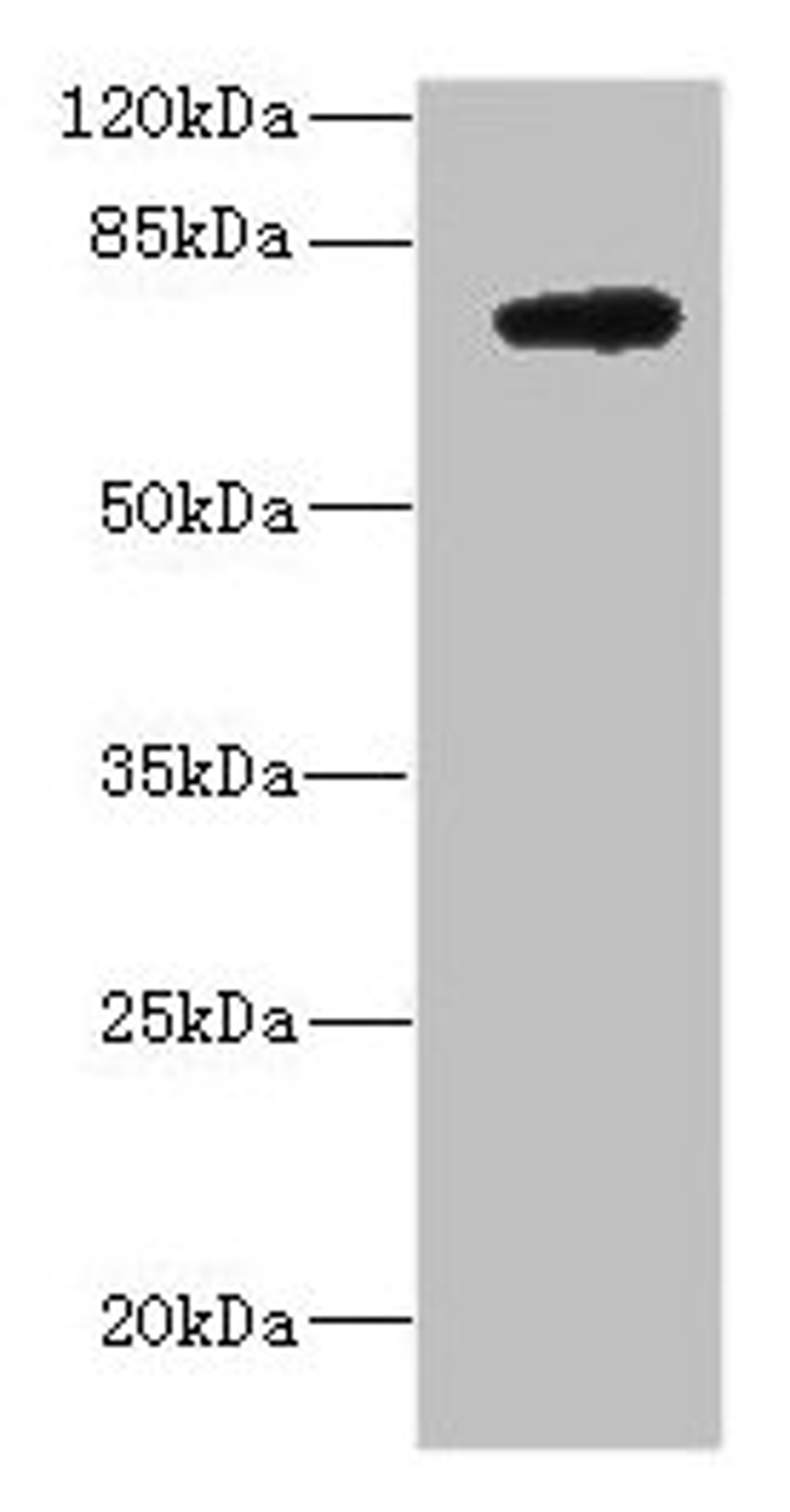 Western blot. All lanes: DARS2 antibody at 10ug/ml + MCF-7 whole cell lysate. Secondary. Goat polyclonal to rabbit IgG at 1/10000 dilution. Predicted band size: 74 kDa. Observed band size: 74 kDa. 