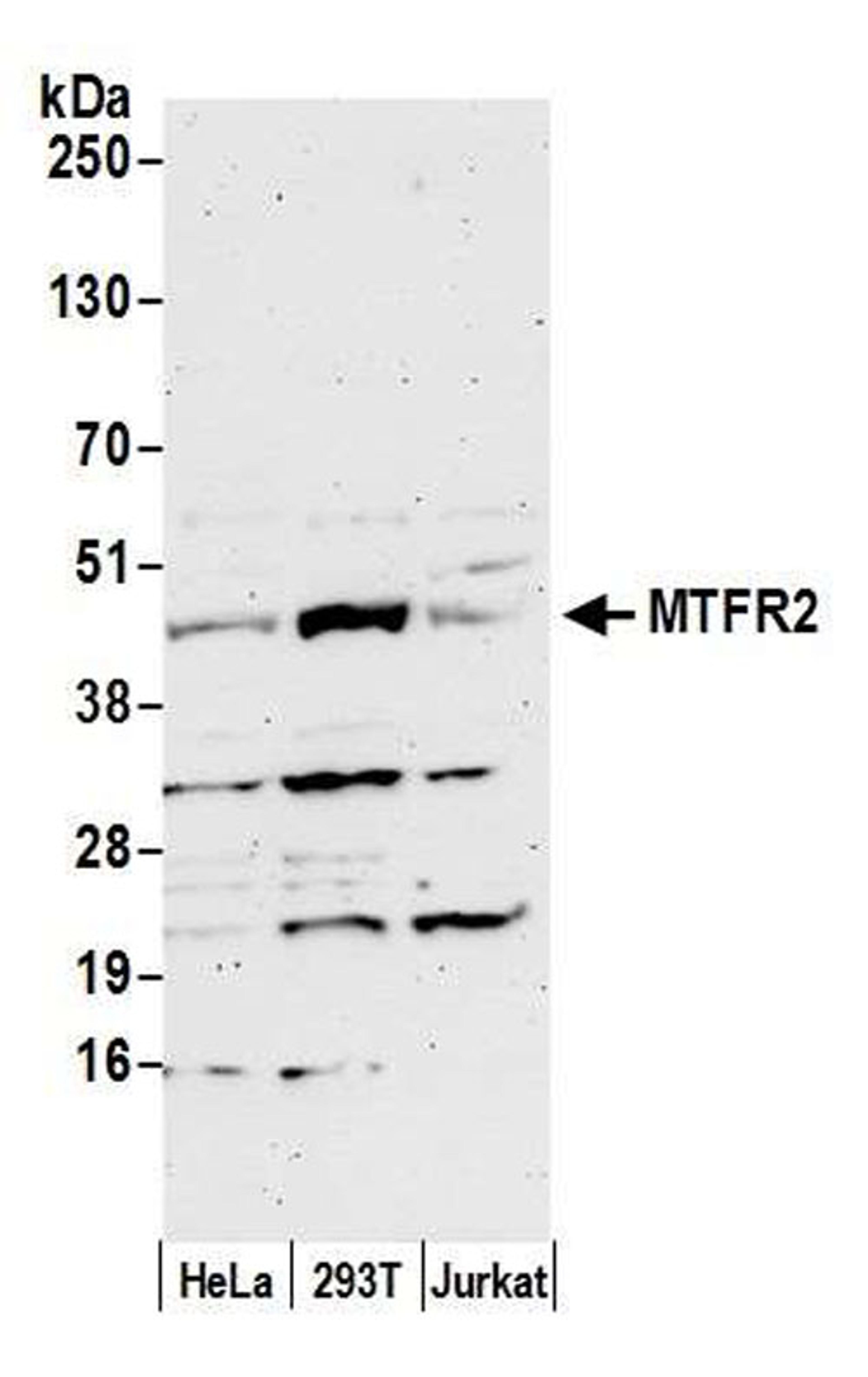 Detection of human MTFR2 by WB.