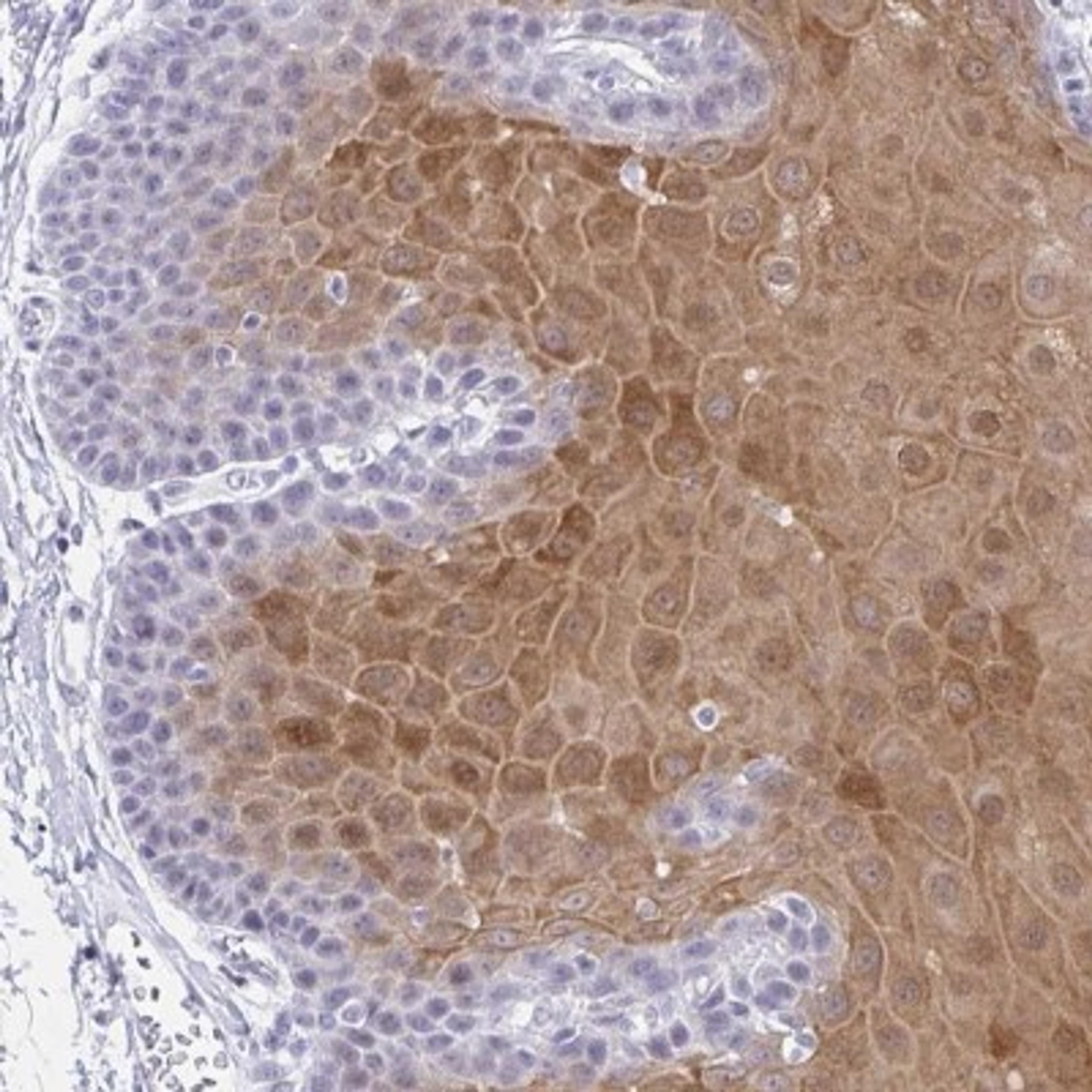 Immunohistochemistry: GPR171 Antibody [NBP2-32359] - Staining of human esophagus shows cytoplasmic and nuclear positivity in squamous epithelial cells.