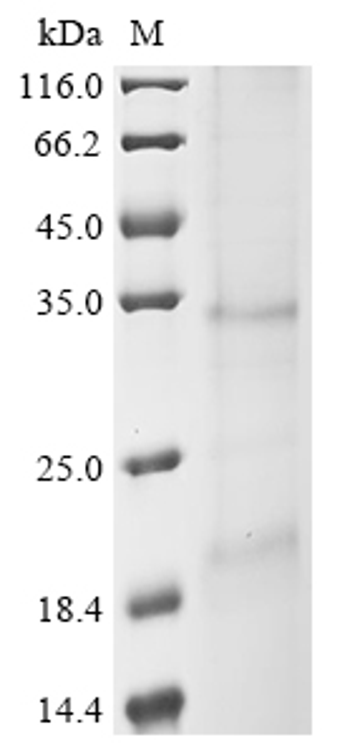 (Tris-Glycine gel) Discontinuous SDS-PAGE (reduced) with 5% enrichment gel and 15% separation gel.