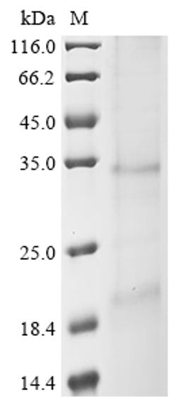 (Tris-Glycine gel) Discontinuous SDS-PAGE (reduced) with 5% enrichment gel and 15% separation gel.