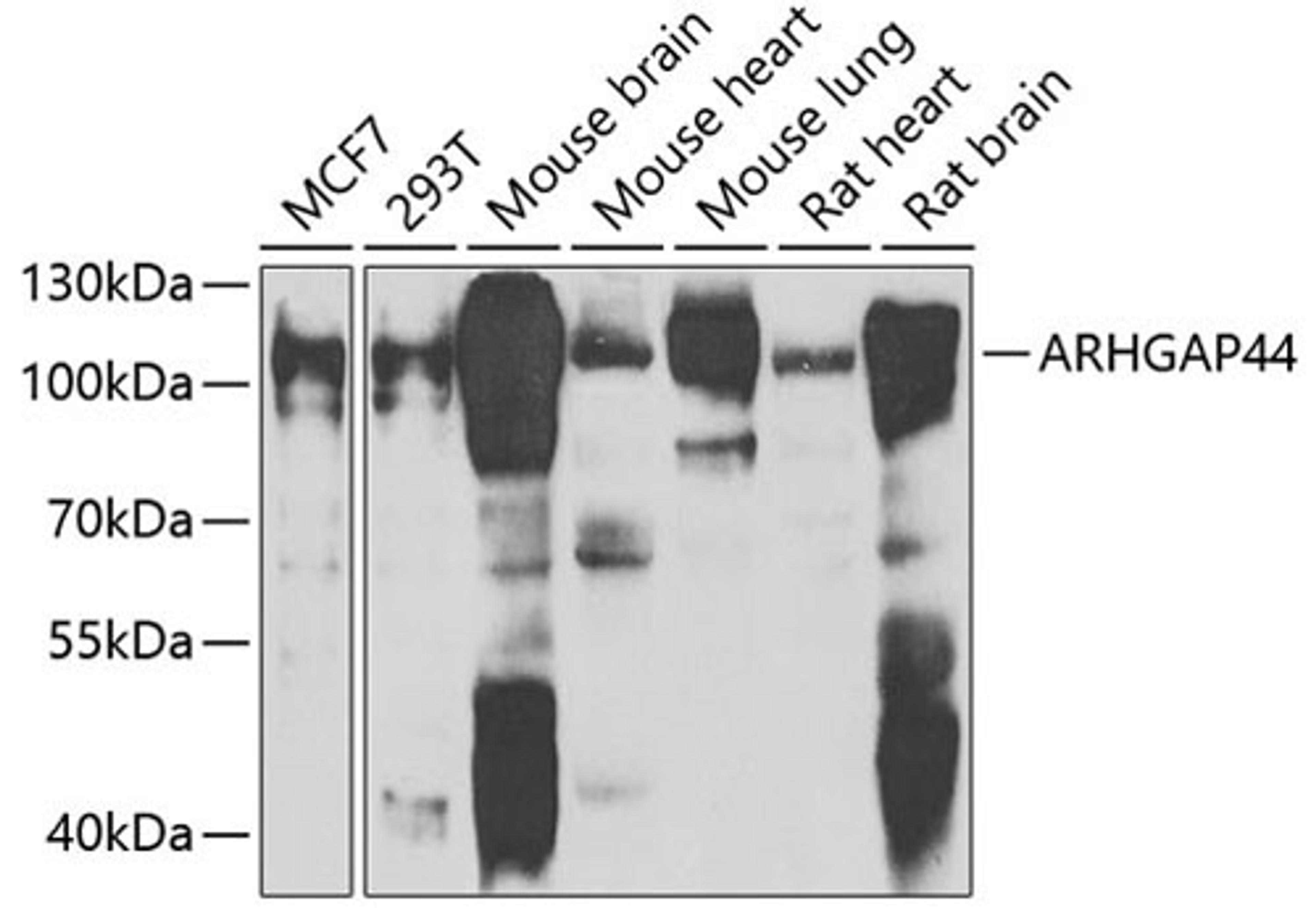 Western blot - ARHGAP44 antibody (A7357)