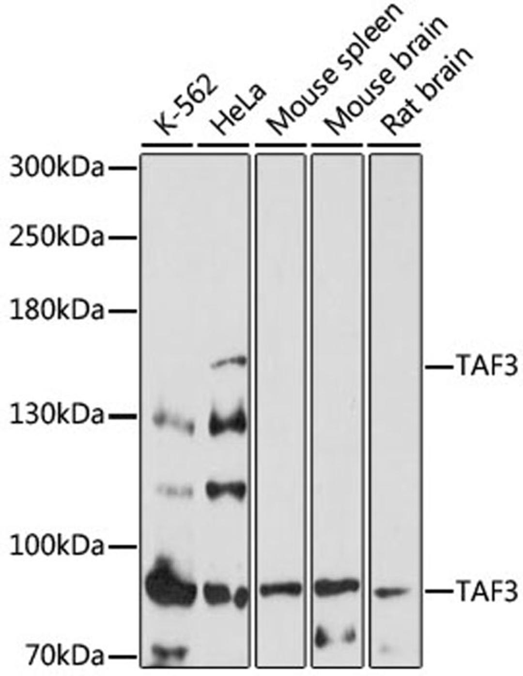 Western blot - TAF3 antibody (A17358)