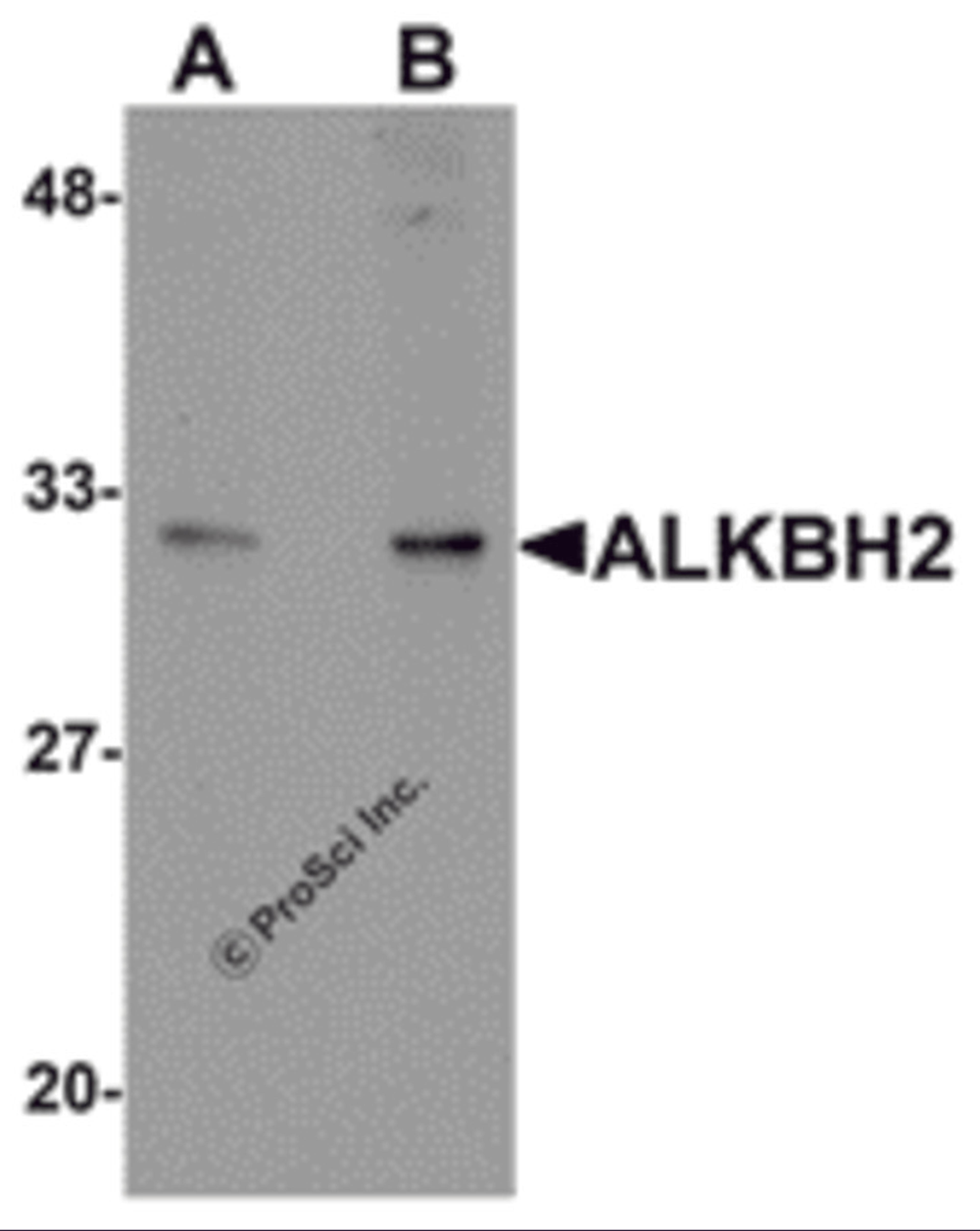 Western blot analysis of ALKBH2 in human kidney tissue lysate with ALKBH2 antibody at (A) 1 and (B) 2 &#956;g/mL.