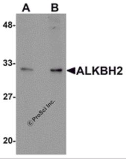 Western blot analysis of ALKBH2 in human kidney tissue lysate with ALKBH2 antibody at (A) 1 and (B) 2 μg/mL.