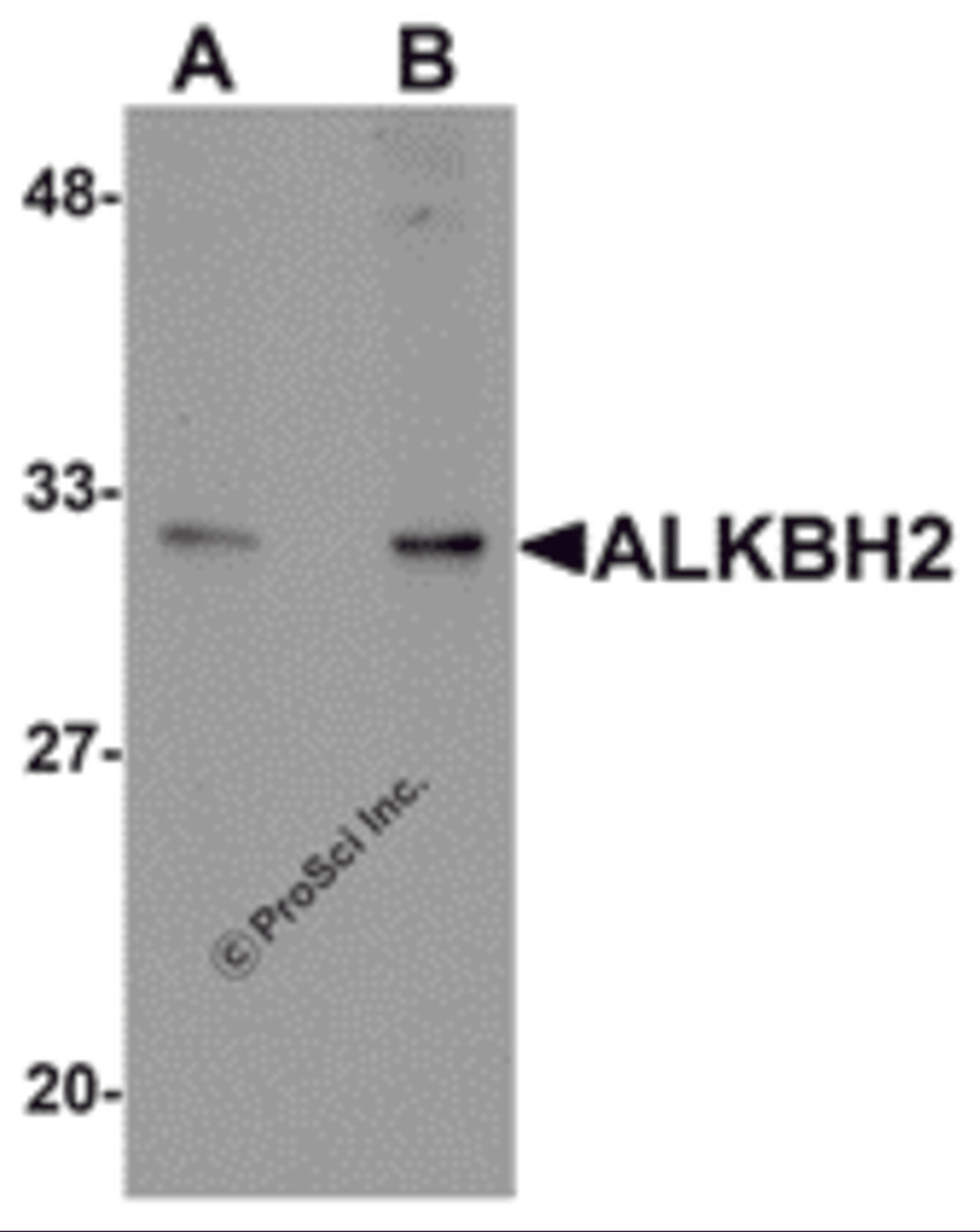 Western blot analysis of ALKBH2 in human kidney tissue lysate with ALKBH2 antibody at (A) 1 and (B) 2 μg/mL.