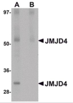 Western blot analysis of JMJD4 in human spleen tissue lysate with JMJD4 antibody at 1 &#956;g/mL in (A) the absence and (B) the presence of blocking peptide.