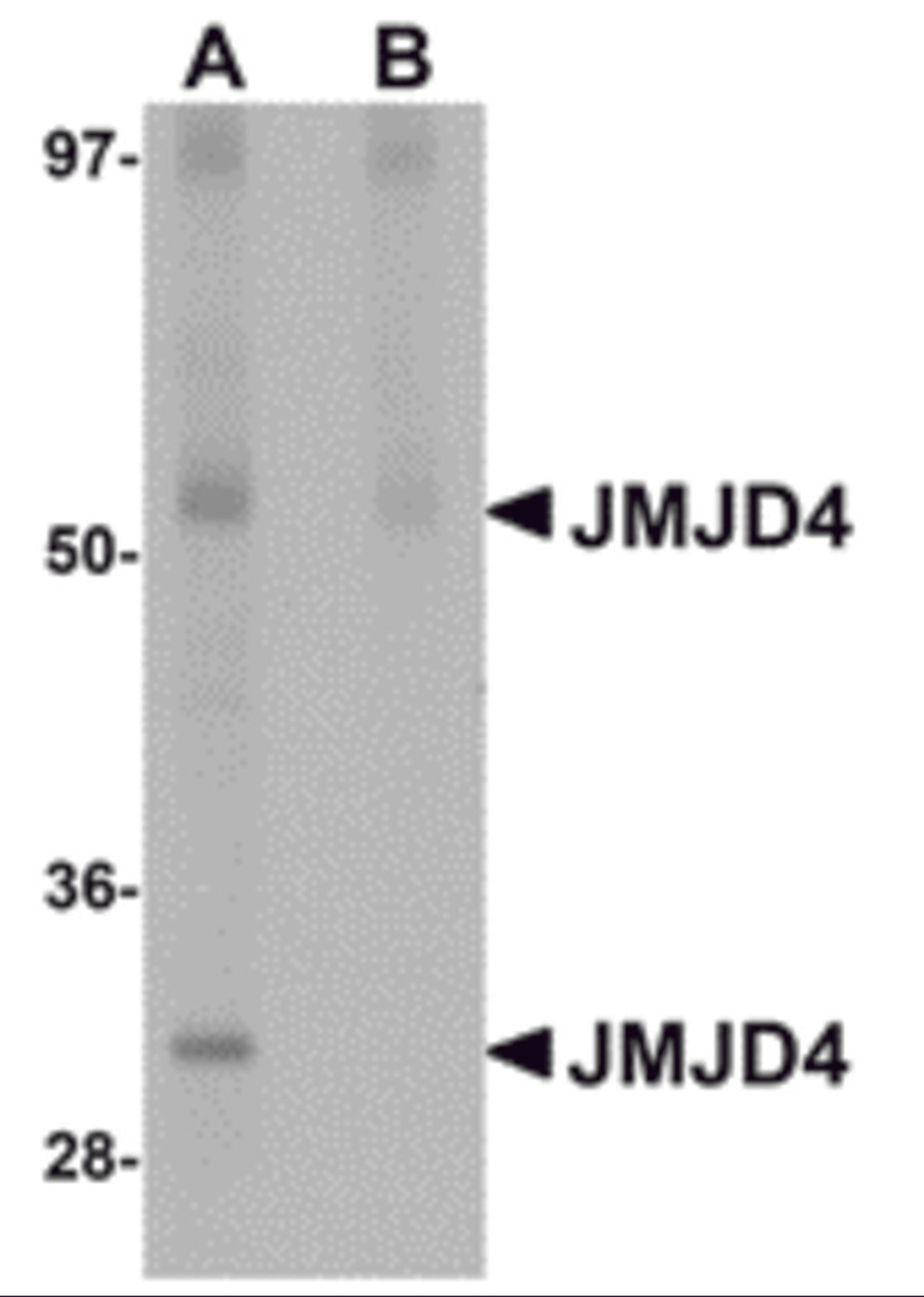 Western blot analysis of JMJD4 in human spleen tissue lysate with JMJD4 antibody at 1 &#956;g/mL in (A) the absence and (B) the presence of blocking peptide.