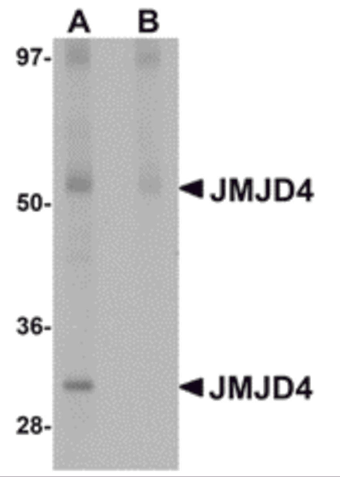 Western blot analysis of JMJD4 in human spleen tissue lysate with JMJD4 antibody at 1 μg/mL in (A) the absence and (B) the presence of blocking peptide.