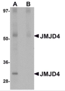 Western blot analysis of JMJD4 in human spleen tissue lysate with JMJD4 antibody at 1 μg/mL in (A) the absence and (B) the presence of blocking peptide.