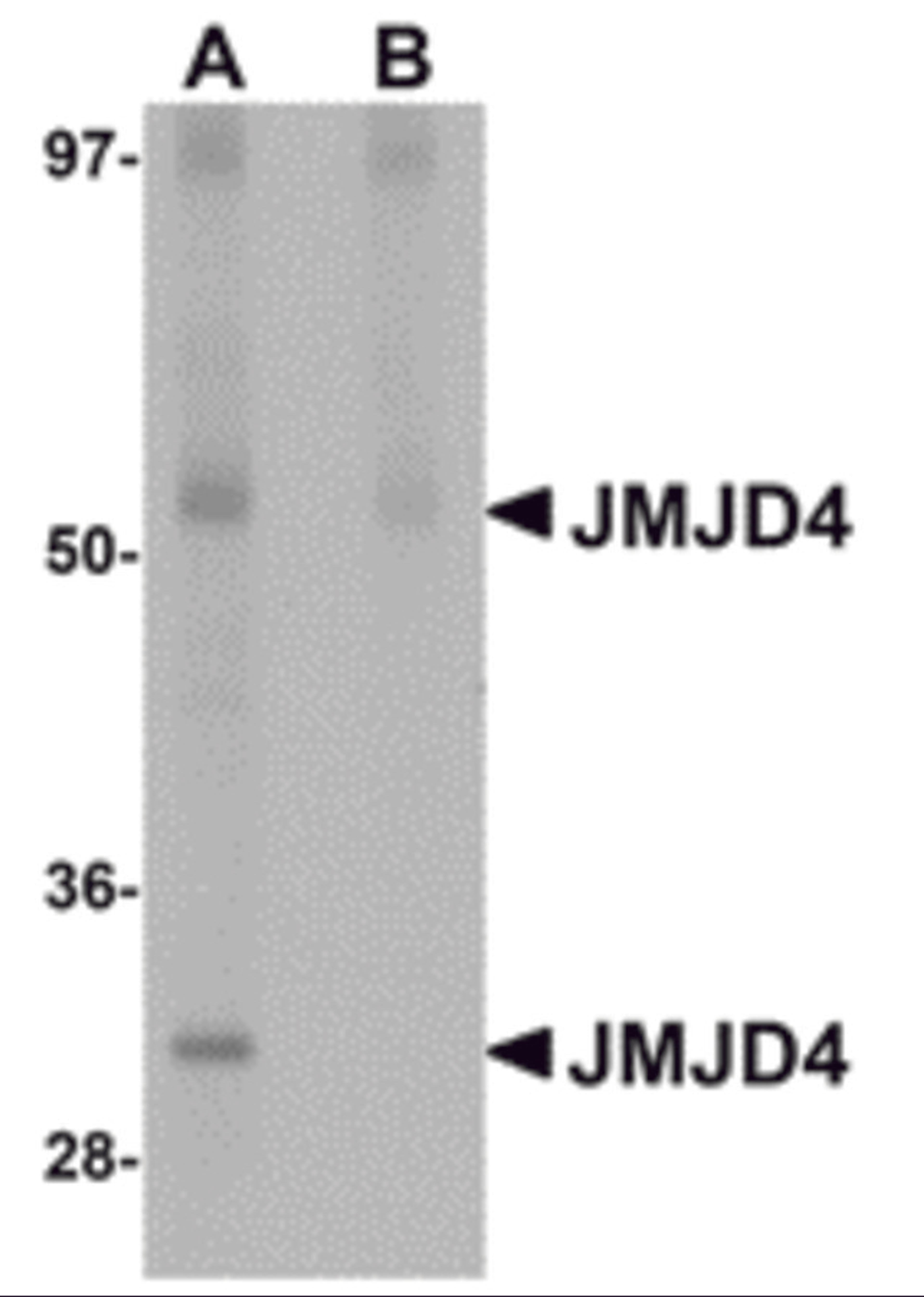 Western blot analysis of JMJD4 in human spleen tissue lysate with JMJD4 antibody at 1 μg/mL in (A) the absence and (B) the presence of blocking peptide.