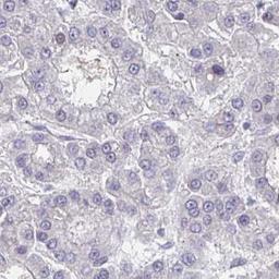 Immunohistochemistry: OR4X2 Antibody [NBP2-31810] - liver cancer