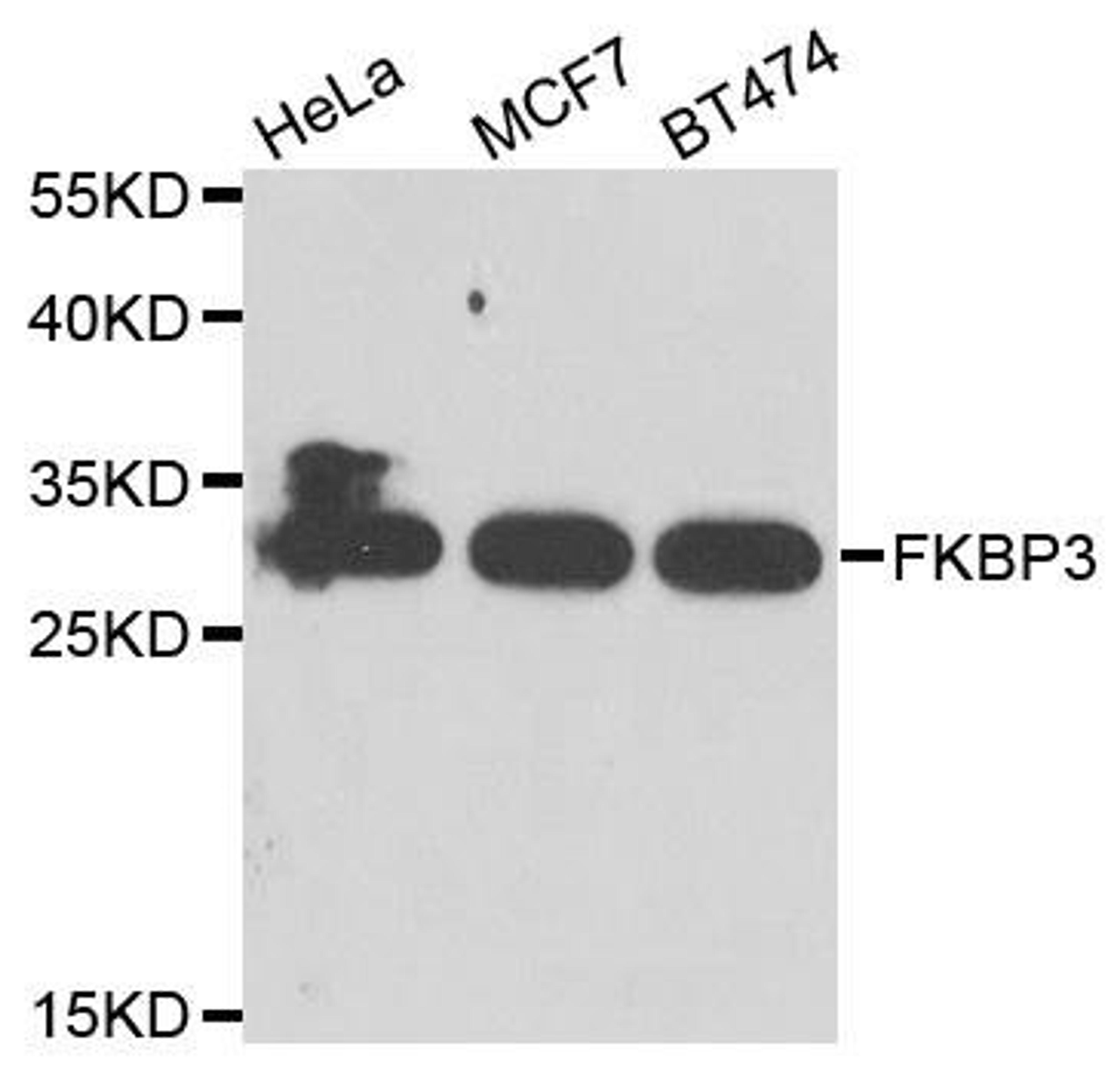 Western blot analysis of extracts of various cell lines using FKBP3 antibody