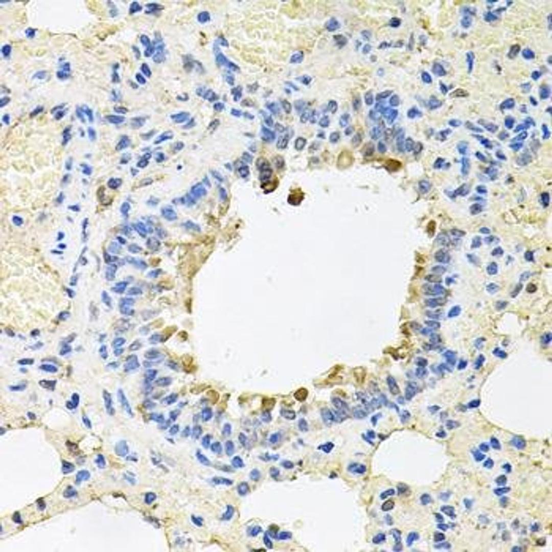 Immunohistochemical staining of mouse stomach tissue using SKAP2 antibody (dilution of 1:100)