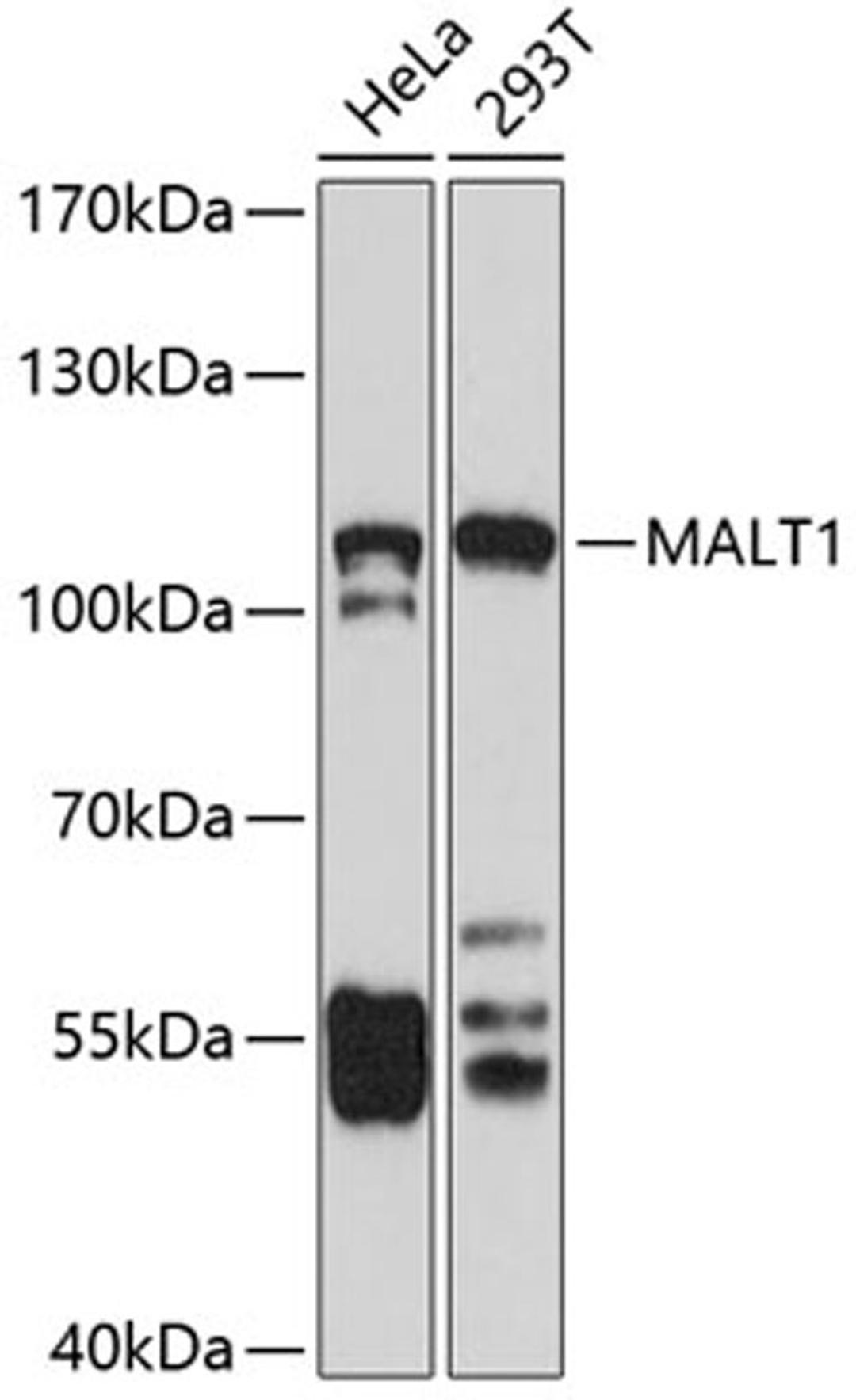 Western blot - MALT1 antibody (A2144)