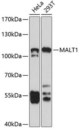 Western blot - MALT1 antibody (A2144)