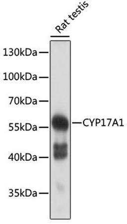 Western blot - CYP17A1 antibody (A13968)