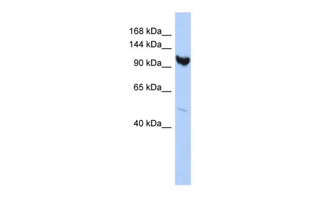 Antibody used in WB on Human HepG2 at 0.2-1 ug/ml.