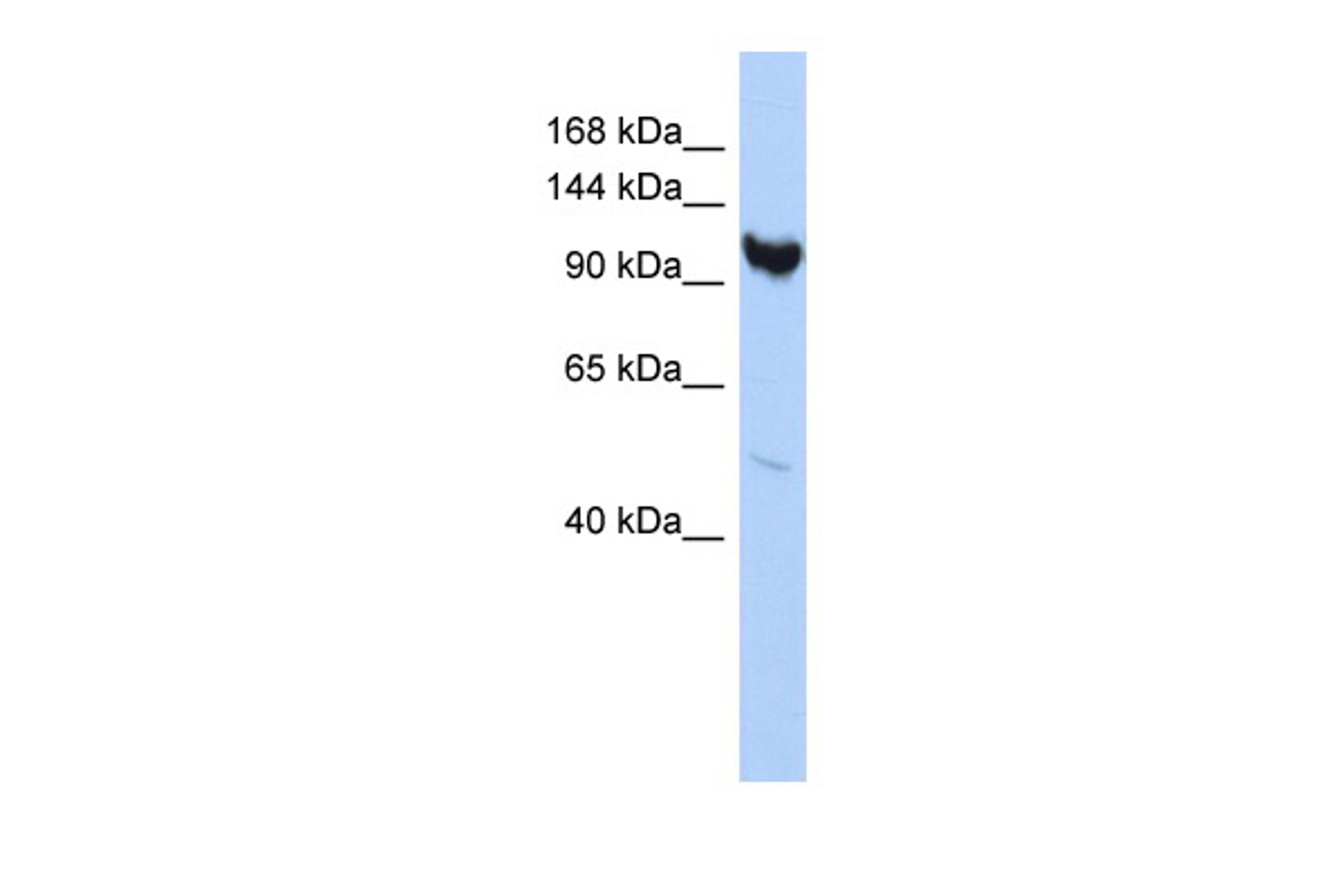 Antibody used in WB on Human HepG2 at 0.2-1 ug/ml.