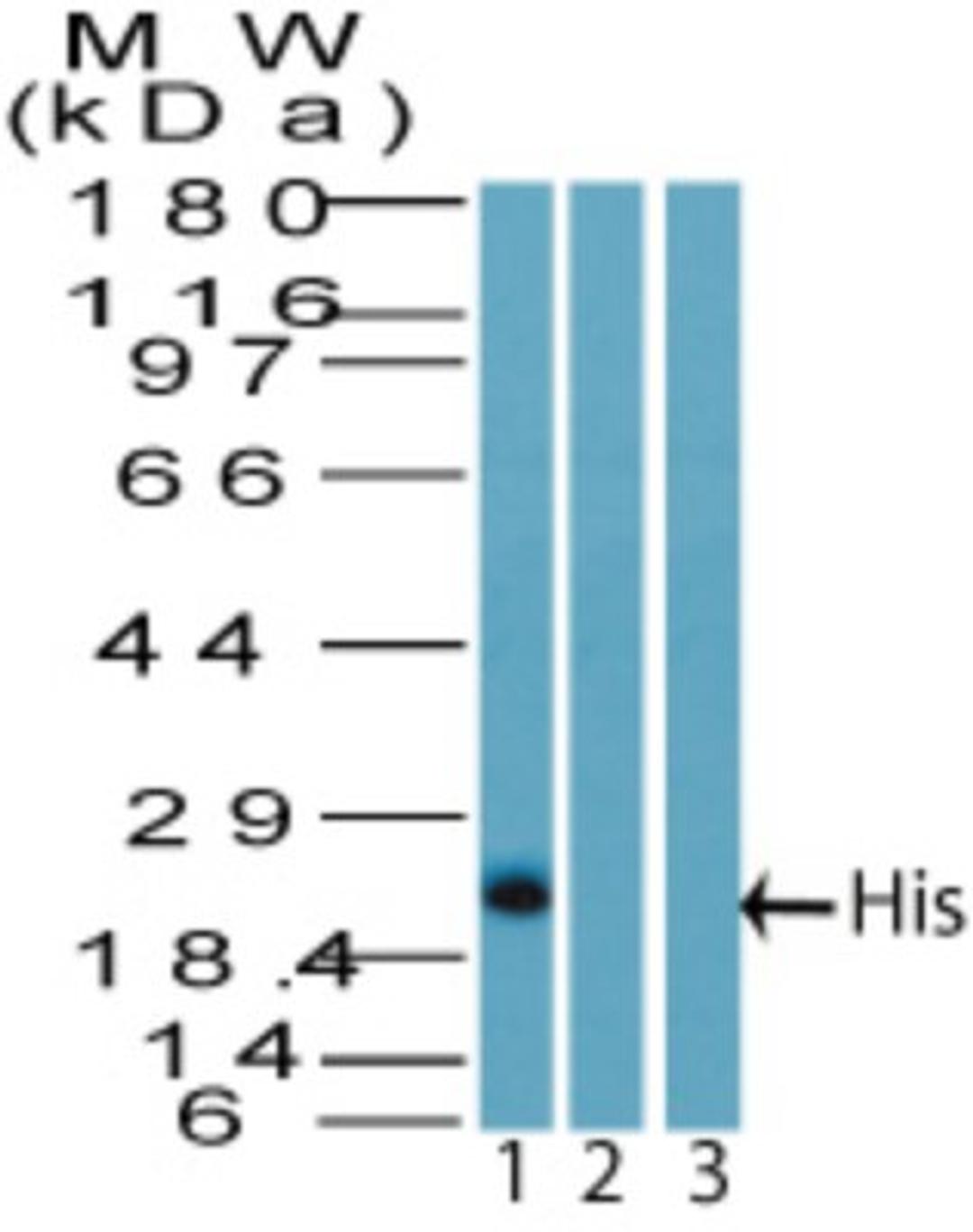 Western Blot: Histidase Antibody [NBP2-27348] - analysis of His on a His tagged recombinant protein in the 1) absence and 2) presence of immunizing peptide and 3) GST tagged (non His) recombinant protein using His antibody at 2 ug/ml.