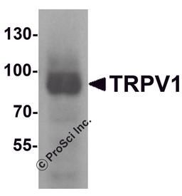 Western blot analysis of TRPV1 in K562 cell lysate with TRPV1 antibody at 1 μg/mL.