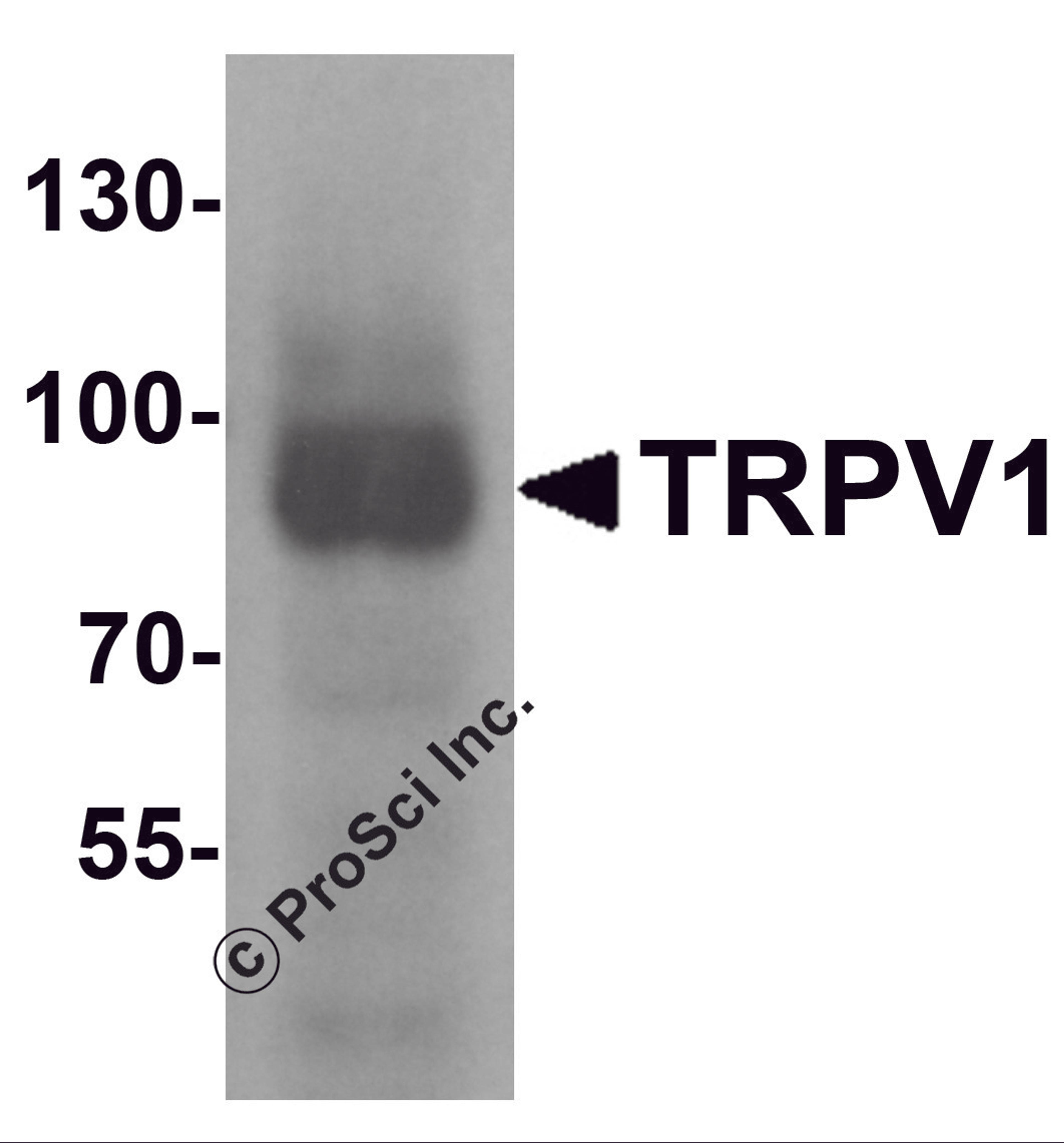 Western blot analysis of TRPV1 in K562 cell lysate with TRPV1 antibody at 1 μg/mL.