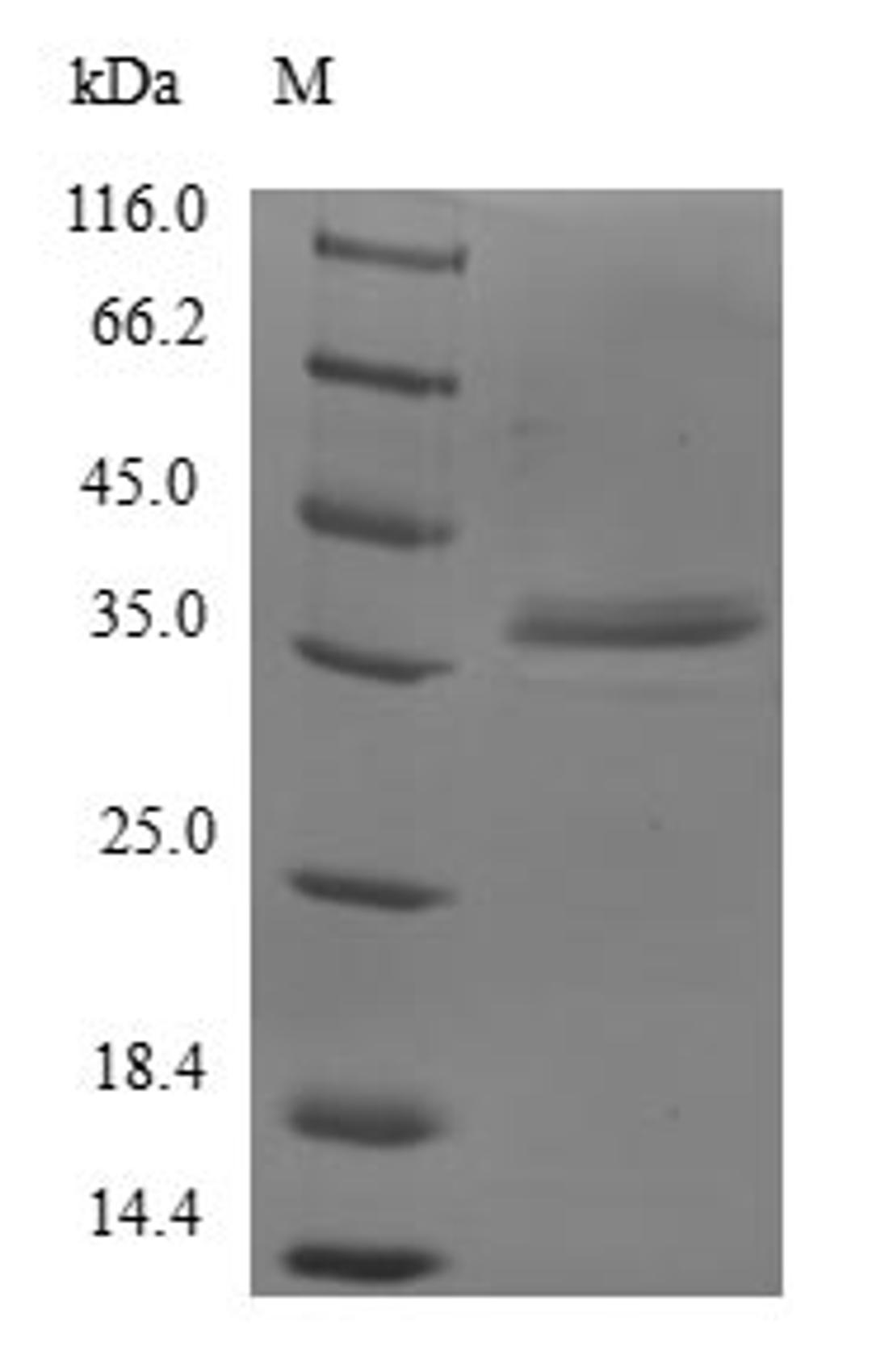 (Tris-Glycine gel) Discontinuous SDS-PAGE (reduced) with 5% enrichment gel and 15% separation gel.