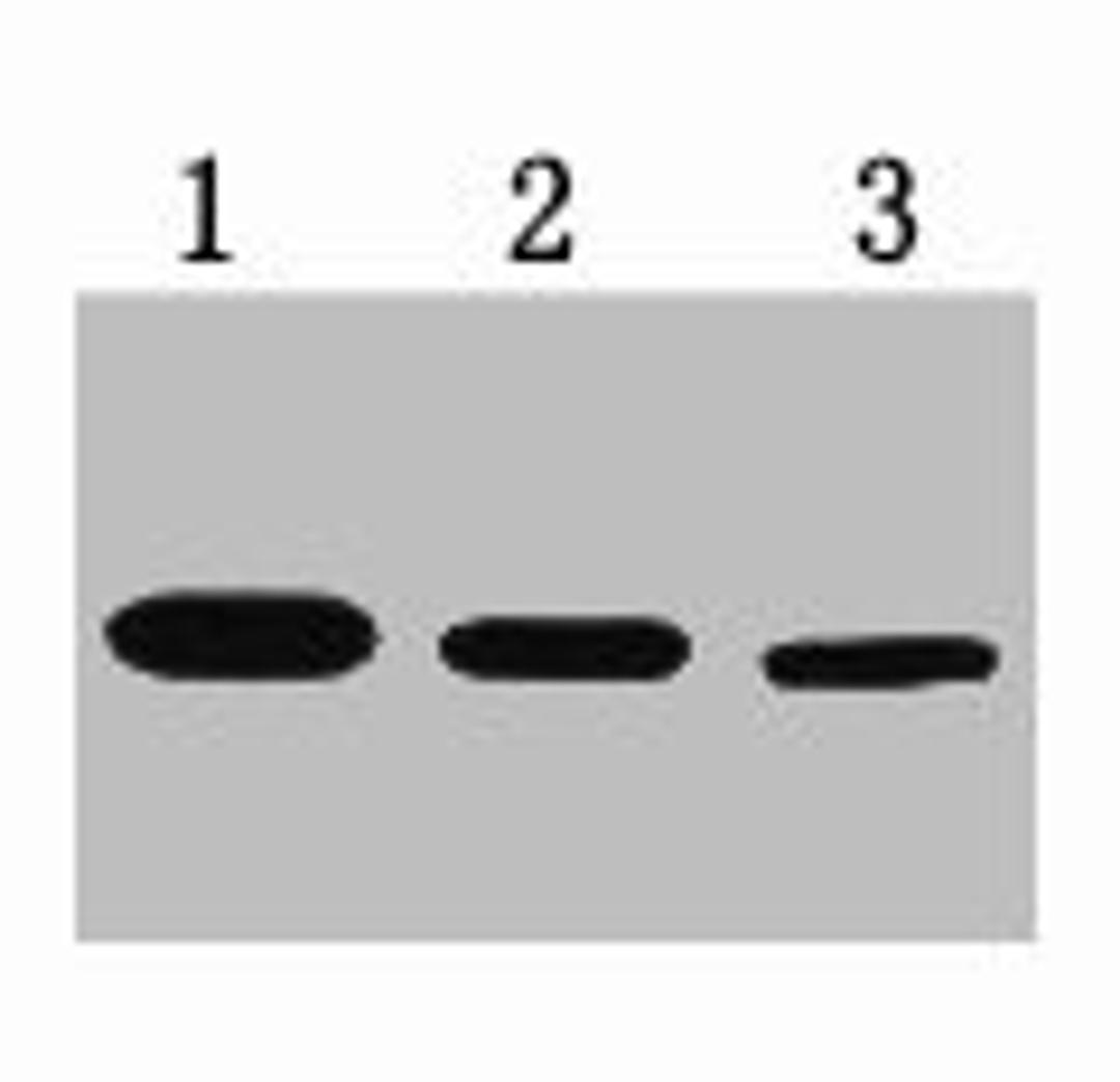 0.5ug T7 fusion protein+ Primary antibody dilution at 1) 1:3000 2) 1:5000 3) 1:10000