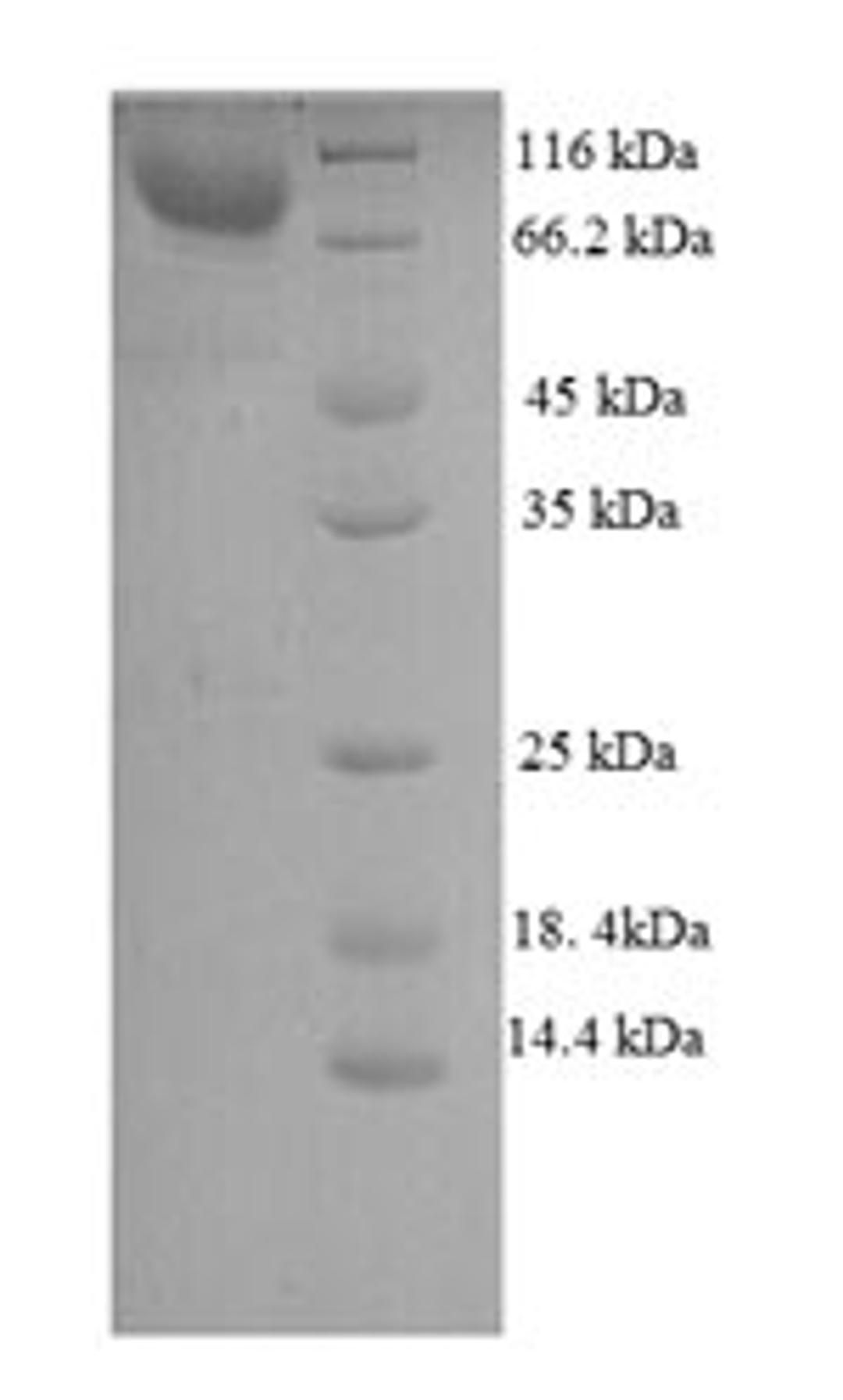 (Tris-Glycine gel) Discontinuous SDS-PAGE (reduced) with 5% enrichment gel and 15% separation gel.