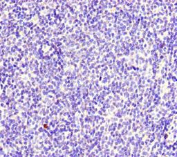 Immunohistochemistry of paraffin-embedded human lymph node tissue using CSB-PA015344LA01HU at dilution of 1:100