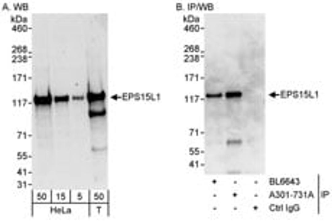 Detection of human EPS15L1 by western blot and immunoprecipitation.