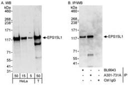 Detection of human EPS15L1 by western blot and immunoprecipitation.