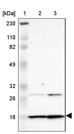 Western Blot: Dynein light chain 4 Antibody [NBP1-84227] - Lane 1: Marker [kDa] 230, 110, 82, 49, 32, 26, 18<br/>Lane 2: Human cell line RT-4<br/>Lane 3: Human cell line U-251MG sp