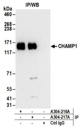 Detection of human CHAMP1 by western blot of immunoprecipitates.