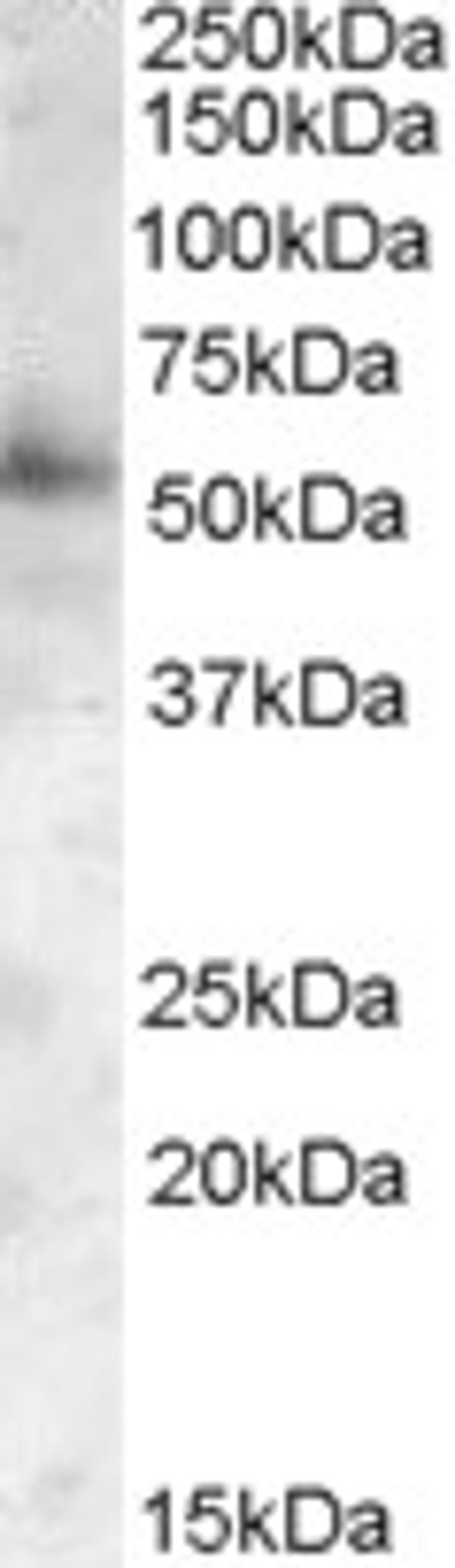 46-194 (0.05ug/ml) staining of Human Frontal Cortex lysate (35ug protein in RIPA buffer). Primary incubation was 1 hour. Detected by chemiluminescence.