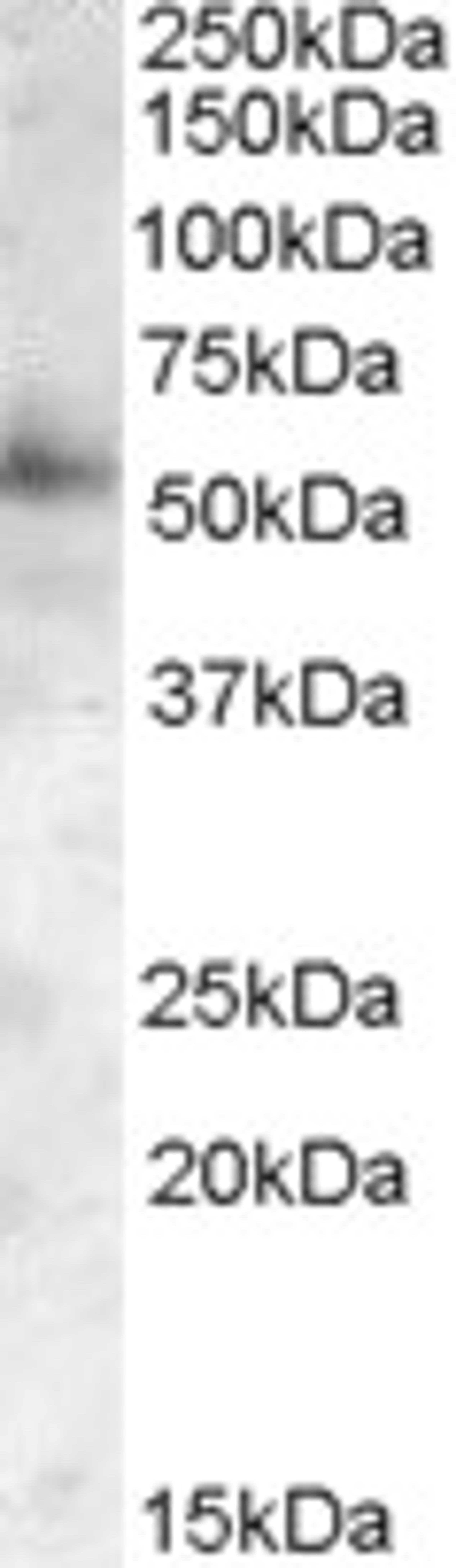 46-194 (0.05ug/ml) staining of Human Frontal Cortex lysate (35ug protein in RIPA buffer). Primary incubation was 1 hour. Detected by chemiluminescence.