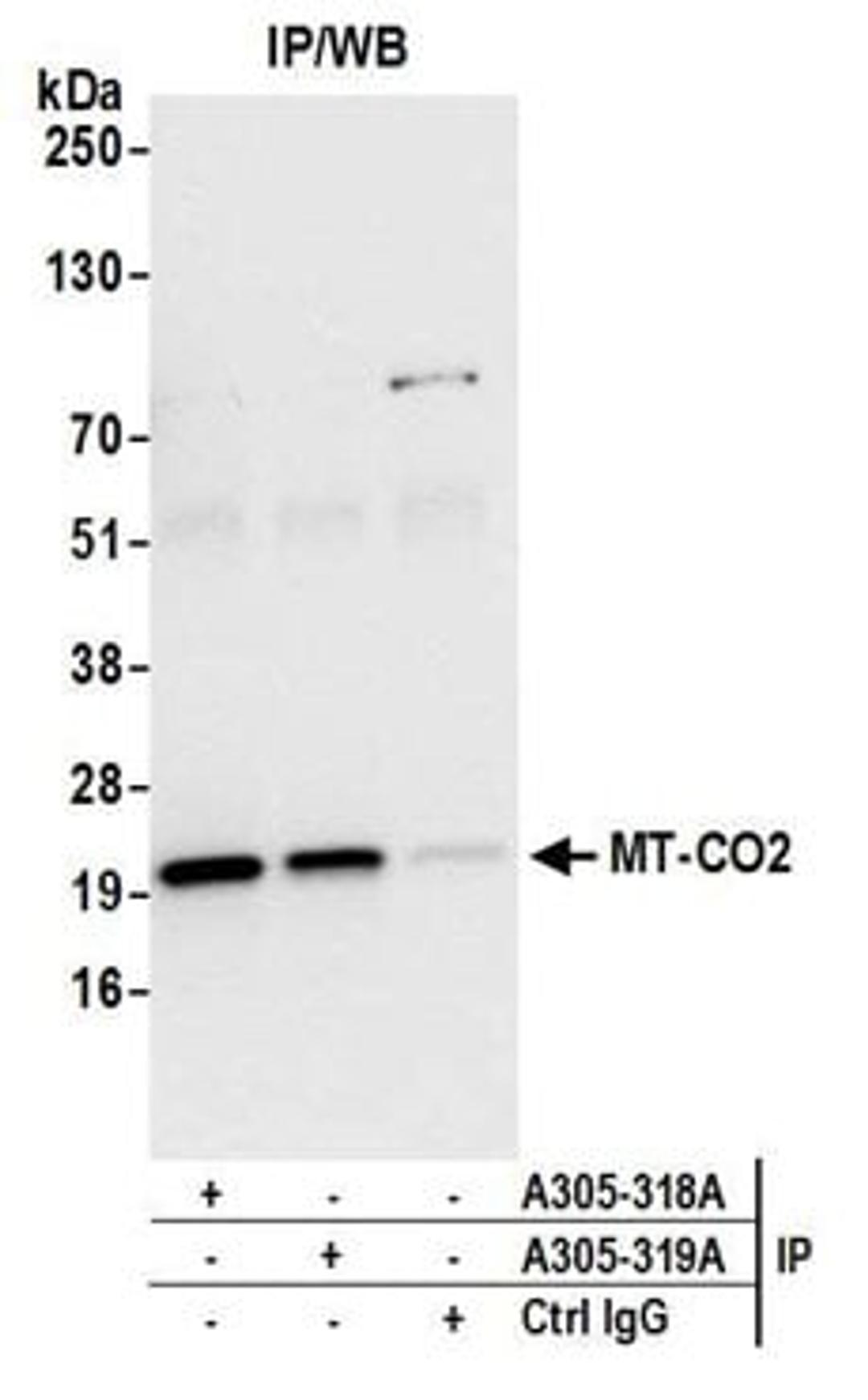 Detection of human MT-CO2 by western blot of immunoprecipitates.