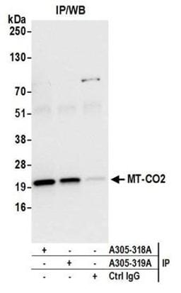 Detection of human MT-CO2 by western blot of immunoprecipitates.