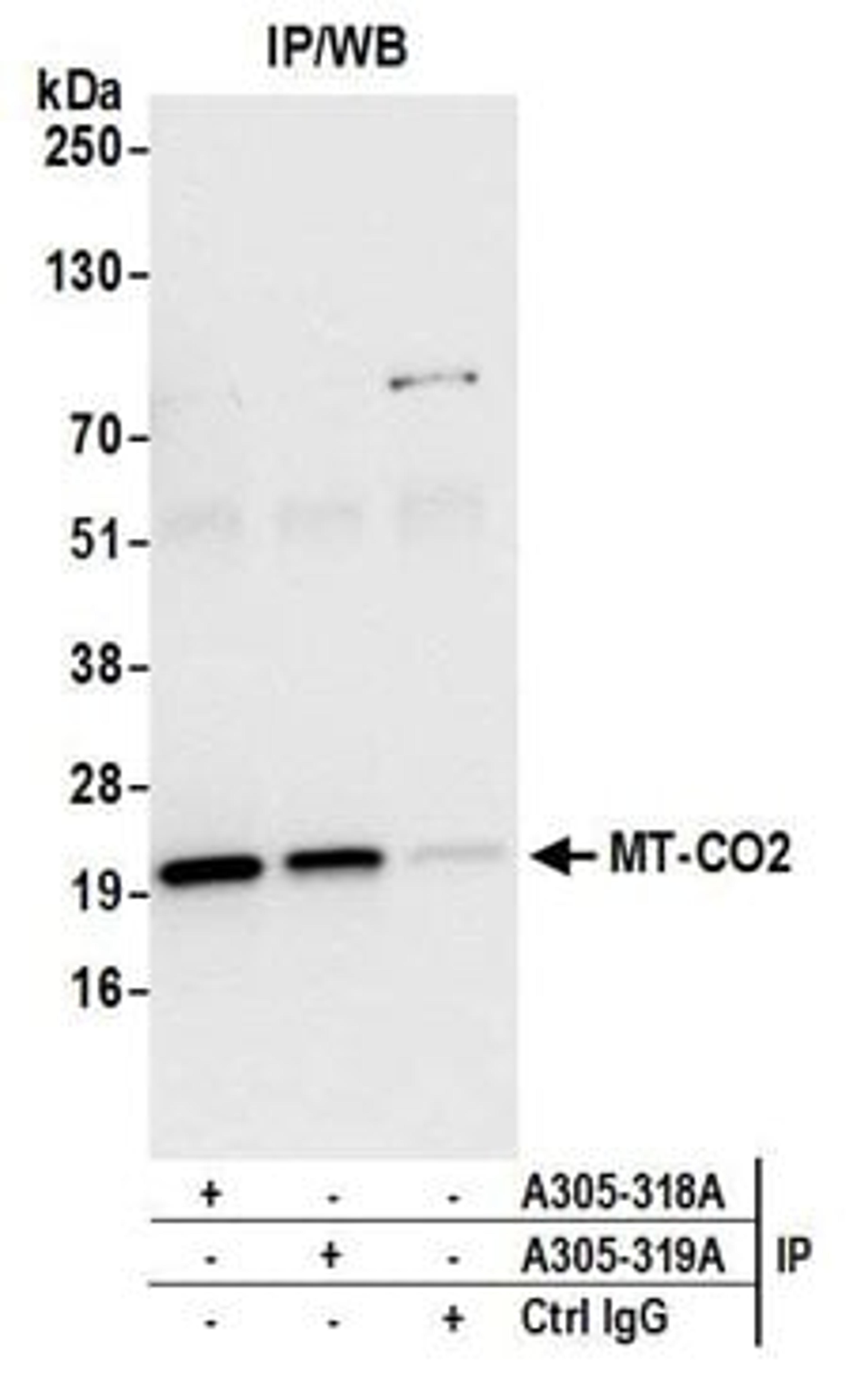 Detection of human MT-CO2 by western blot of immunoprecipitates.