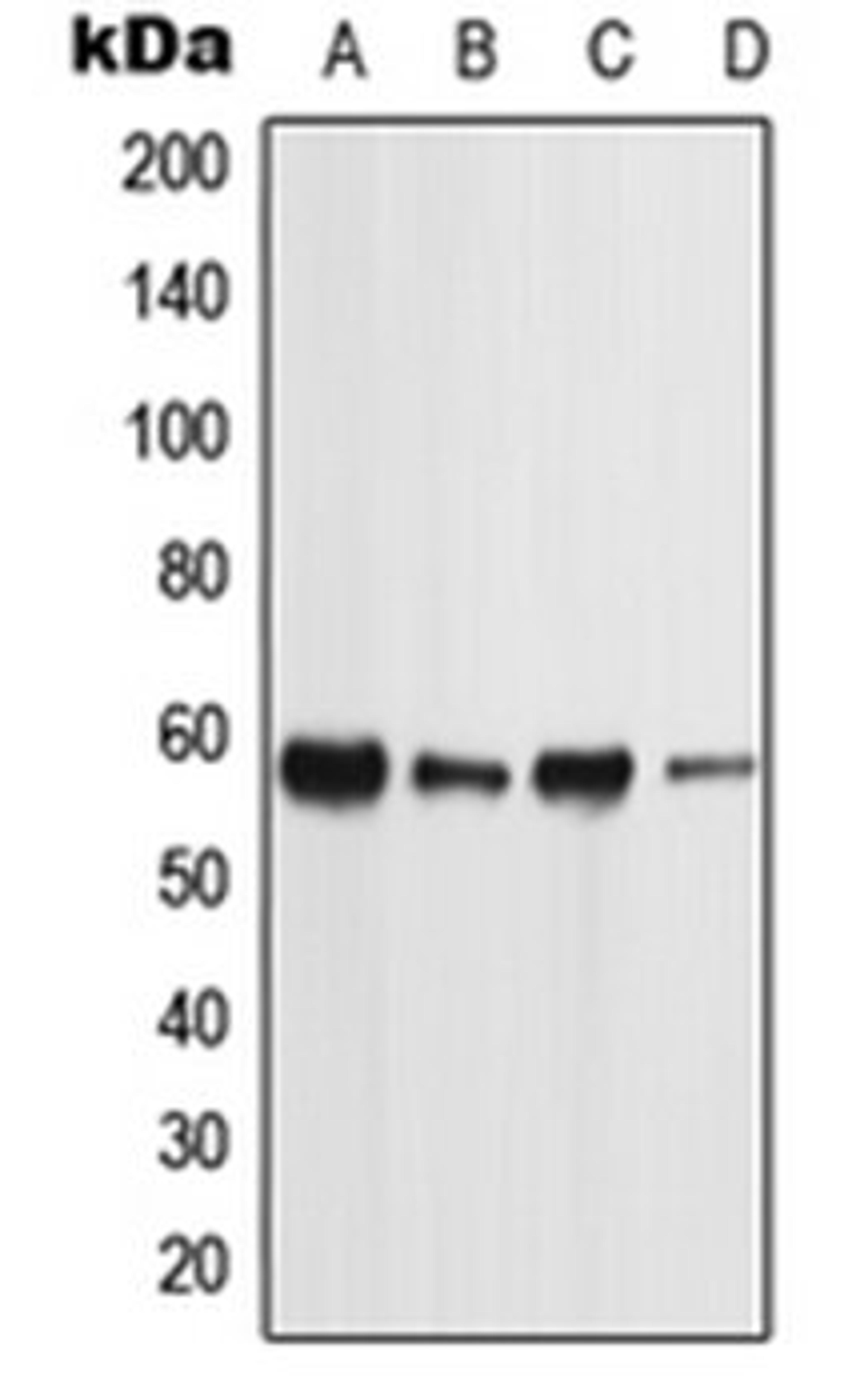 Western blot analysis of MCF7 (Lane 1), NTERA2 (Lane 2), Raw264.7 (Lane 3), H9C2 (Lane 4) whole cell lysates using PIGW antibody