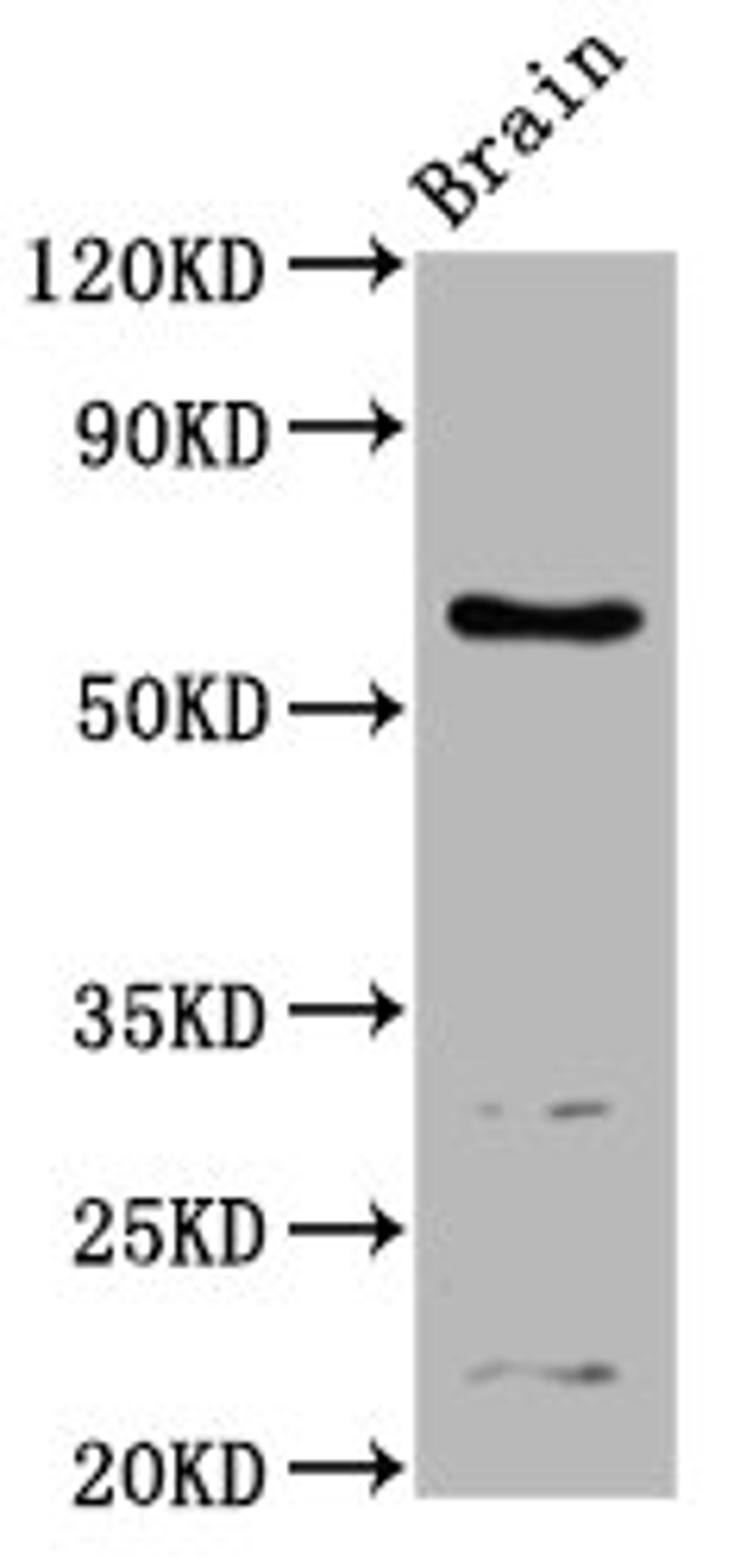 Western Blot. Positive WB detected in: Mouse brain tissue. All lanes: ASIC1 antibody at 4.24ug/ml. Secondary. Goat polyclonal to rabbit IgG at 1/50000 dilution. Predicted band size: 60, 65, 63 kDa. Observed band size: 60 kDa.