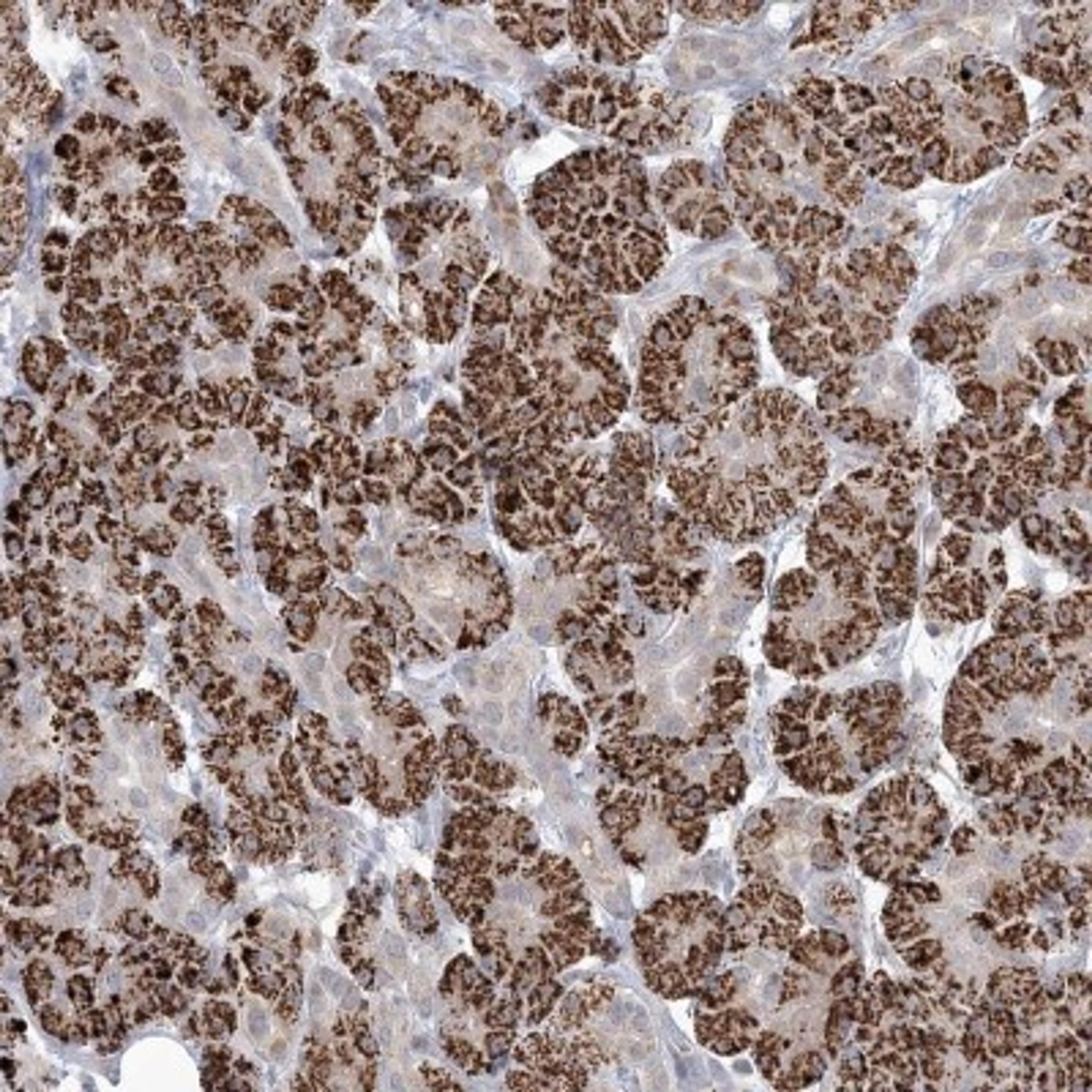 Immunohistochemistry: TBC1D14 Antibody [NBP2-32678] - Staining of human pancreas shows strong cytoplasmic positivity in exocrine glandular cells.