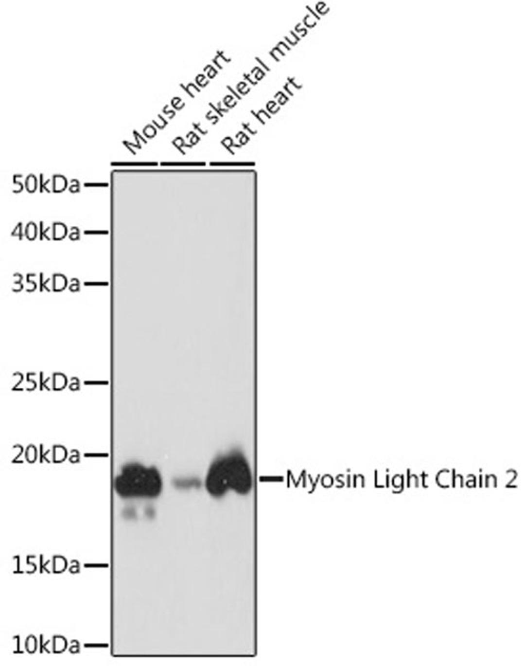 Western blot - Myosin Light Chain 2 Rabbit mAb (A8742)