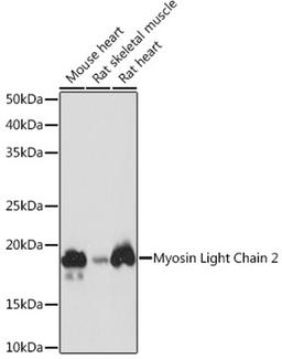 Western blot - Myosin Light Chain 2 Rabbit mAb (A8742)