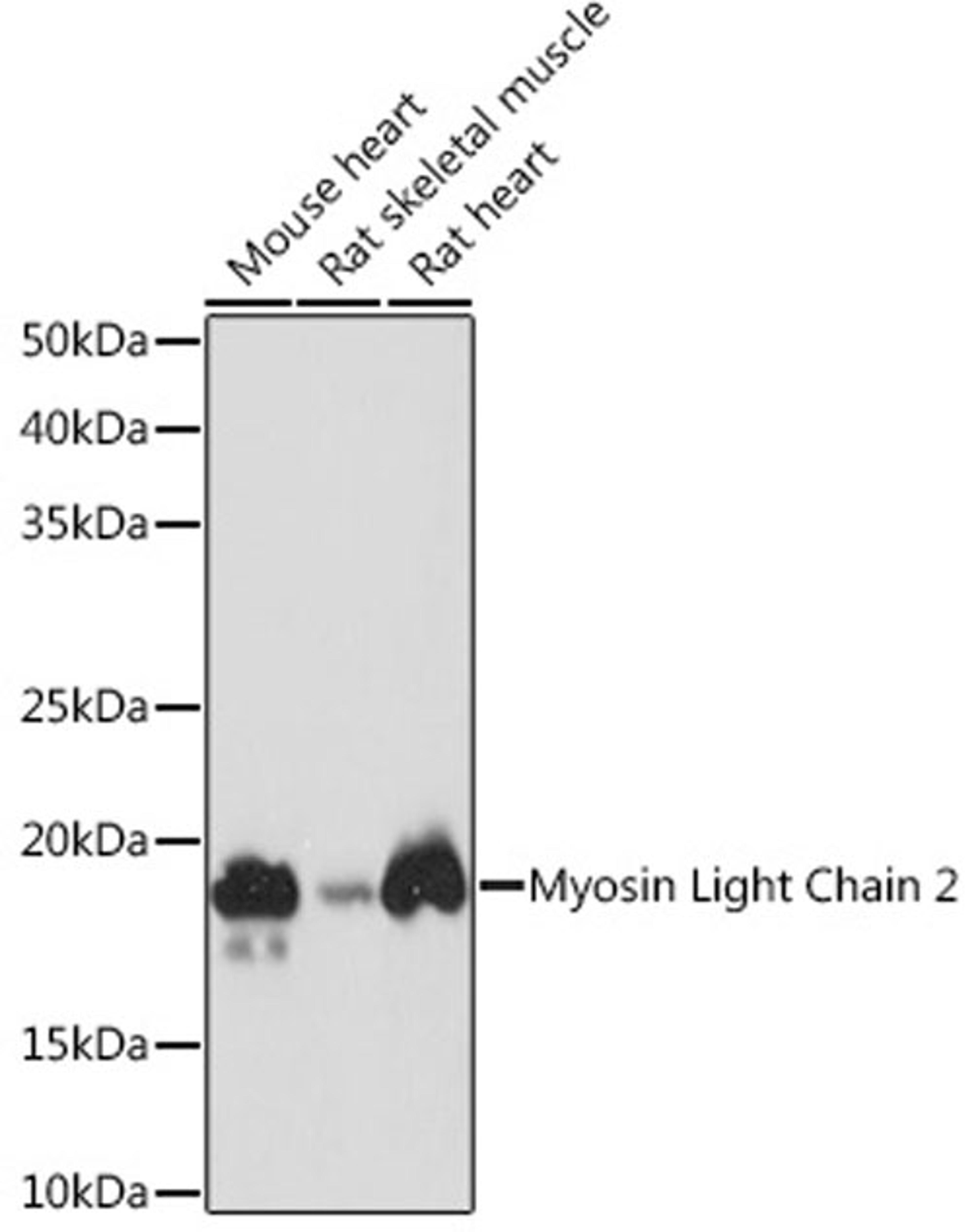 Western blot - Myosin Light Chain 2 Rabbit mAb (A8742)