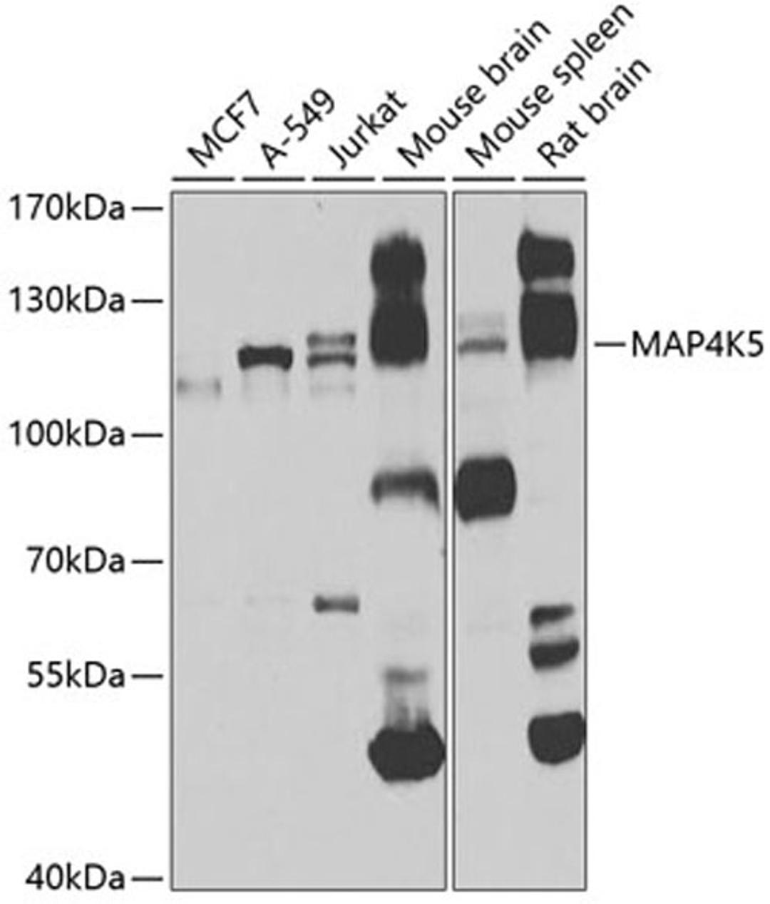 Western blot - MAP4K5 antibody (A7962)