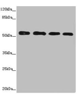Western blot. All lanes: CALCOCO2 antibody at 3.66ug/ml. Lane 1: Hela whole cell lysate. Lane 2: Jurkat whole cell lysate. Lane 3: 293T whole cell lysate. Lane 4: Raji whole cell lysate. Secondary. Goat polyclonal to rabbit IgG at 1/10000 dilution. Predicted band size: 53, 48, 55, 56, 44 kDa. Observed band size: 56 kDa. 