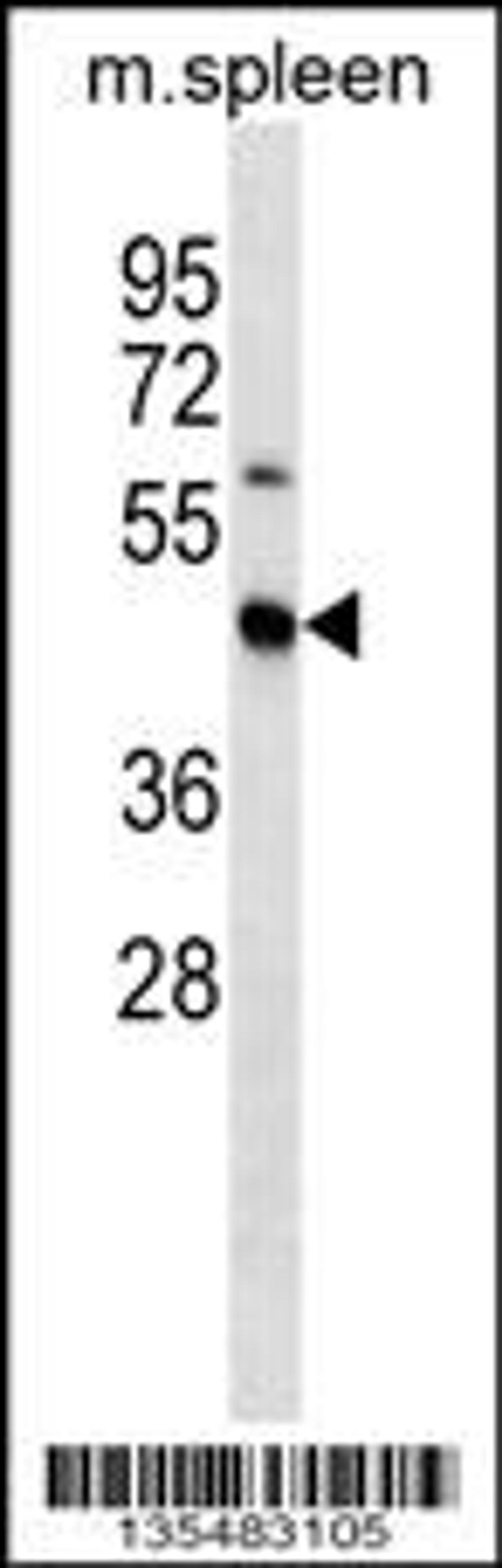 Western blot analysis in mouse spleen tissue lysates (35ug/lane).