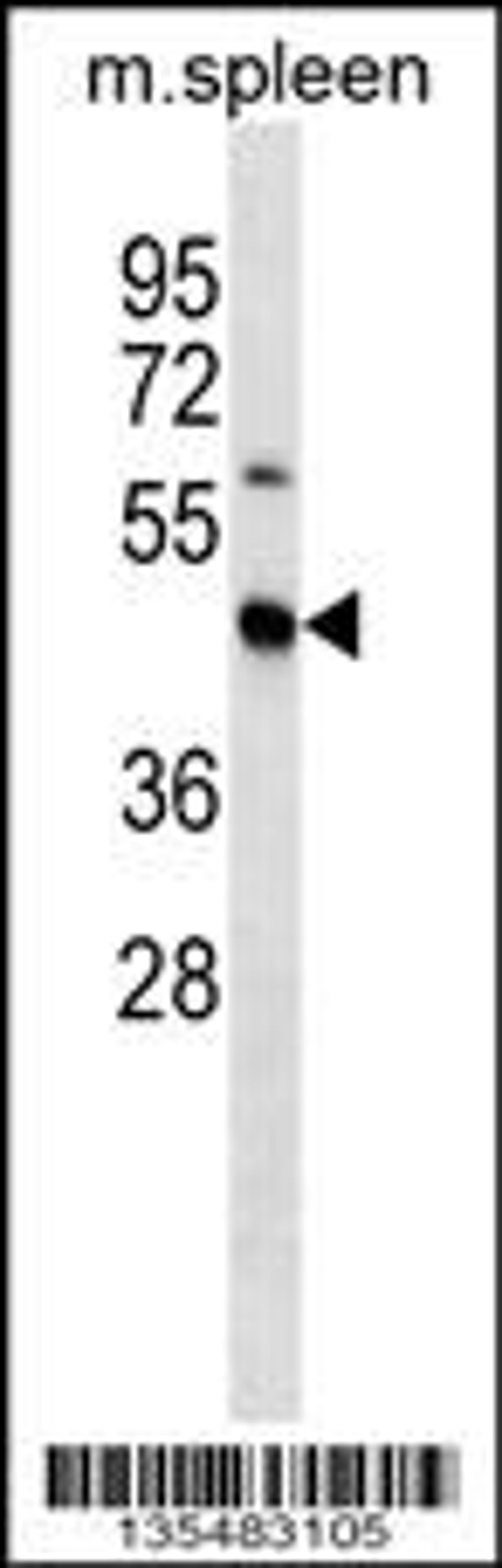 Western blot analysis in mouse spleen tissue lysates (35ug/lane).